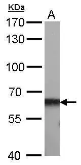 CBS antibody [GT519] detects CBS protein by Western blot analysis. A. 50 μg rat liver lysate/extract 7.5 % SDS-PAGE CBS antibody [GT519] (GTX628777) dilution: 1:1000