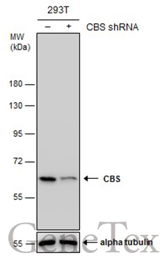 Non-transfected (–) and transfected (+) 293T whole cell extracts (30 μg) were separated by 7.5% SDS-PAGE, and the membrane was blotted with CBS antibody [GT519] (GTX628777) diluted at 1:500.