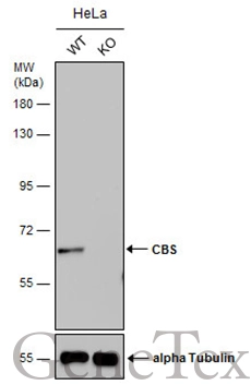 Wild-type (WT) and CBS knockout (KO) HeLa cell extracts (30 μg) were separated by 7.5% SDS-PAGE, and the membrane was blotted with CBS antibody [GT519] (GTX628777) diluted at 1:500. The HRP-conjugated anti-mouse IgG antibody (GTX213111-01) was used to detect the primary antibody.