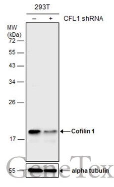 Non-transfected (–) and transfected (+) 293T whole cell extracts (30 μg) were separated by 12% SDS-PAGE, and the membrane was blotted with Cofilin 1 antibody [GT567] (GTX628804) diluted at 1:500. The HRP-conjugated anti-mouse IgG antibody (GTX213111-01) was used to detect the primary antibody.