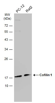 Various whole cell extracts (30 μg) were separated by 12% SDS-PAGE, and the membrane was blotted with Cofilin 1 antibody [GT567] (GTX628804) diluted at 1:1000. The HRP-conjugated anti-mouse IgG antibody (GTX213111-01) was used to detect the primary antibody.