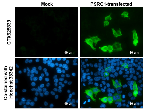 PSRC1 antibody [GT615] detects PSRC1 protein at cytoplasm by immunofluorescent analysis. Sample: Mock and transfected 293T cells were fixed in 4% paraformaldehyde at RT for 15 min. Green: PSRC1 stained by PSRC1 antibody [GT615] (GTX628833) diluted at 1:2000. Blue: Hoechst 33342 staining. Scale bar= 10 μm.