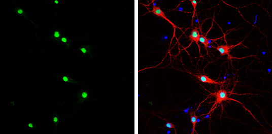 HMGB1 antibody [GT383] detects HMGB1 protein at nucleus by immunofluorescent analysis. Sample: DIV9 rat E18 primary cortical neurons were fixed in 4% paraformaldehyde at RT for 15 min. Green: HMGB1 protein stained by HMGB1 antibody [GT383] (GTX628834) diluted at 1:500. Red: MAP2, stained by MAP2 antibody (GTX133109) diluted at 1:500. Blue: Fluoroshield with DAPI (GTX30920).