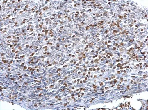 HMGB1 antibody [GT348] detects HMGB1 protein at nucleus on mouse lymph node by immunohistochemical analysis. Sample: Paraffin-embedded mouse lymph node. HMGB1 antibody [GT348] (GTX628835) dilution: 1:500. 
 Antigen Retrieval: Trilogy? (EDTA based, pH 8.0) buffer, 15min