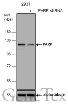 Non-transfected (–) and transfected (+) 293T whole cell extracts (30 μg) were separated by 7.5% SDS-PAGE, and the membrane was blotted with PARP antibody [GT6212] (GTX628836) diluted at 1:1000.