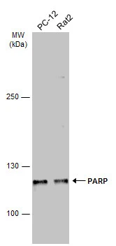 Various whole cell extracts (30 μg) were separated by 5% SDS-PAGE, and the membrane was blotted with PARP antibody [GT6212] (GTX628836) diluted at 1:2000. The HRP-conjugated anti-mouse IgG antibody (GTX213111-01) was used to detect the primary antibody.
