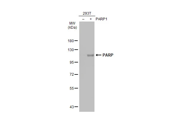 PARP antibody [GT6212]