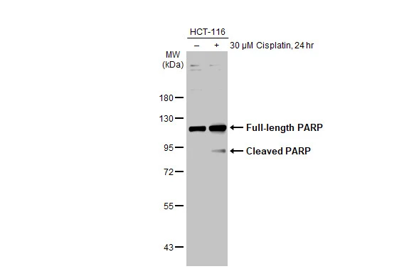 Untreated (–) and treated (+) HCT-116 whole cell extract (30 μg) were separated by 7.5% SDS-PAGE, and the membrane was blotted with PARP antibody [GT6212] (GTX628836) diluted at 1:1000. The HRP-conjugated anti-mouse IgG antibody (GTX213111-01) was used to detect the primary antibody.