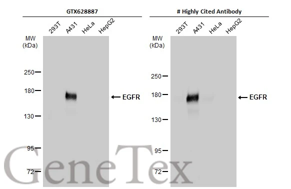 Anti-EGFR antibody [GT133] (GTX628887) | GeneTex