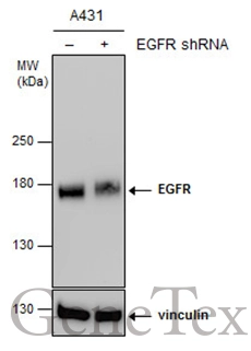 EGFR antibody [GT461]