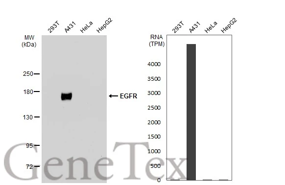 EGFR antibody [GT461]