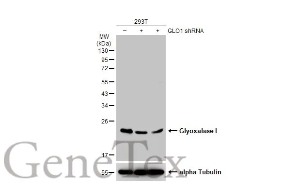 Non-transfected (–) and transfected (+) 293T whole cell extracts (30 μg) were separated by 12% SDS-PAGE, and the membrane was blotted with Glyoxalase I antibody [GT266] (GTX628889) diluted at 1:1000. The HRP-conjugated anti-mouse IgG antibody (GTX213111-01) was used to detect the primary antibody.
