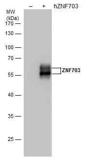 ZNF703 antibody detects ZNF703 protein by western blot analysis. Non-transfected (-) and ZNF703-transfected (+, ) 293T whole cell extracts (30 μg) were separated by 10% SDS-PAGE, and the membrane was blotted with ZNF703 antibody (GTX628896) at a dilution of 1:5000.