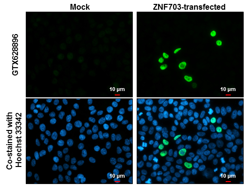 ZNF703 antibody [GT264] detects ZNF703 protein at nucleus by immunofluorescent analysis. Sample: Mock and transfected 293T cells were fixed in 4% paraformaldehyde at RT for 15 min. Green: ZNF703 stained by ZNF703 antibody [GT264] (GTX628896) diluted at 1:2000. Blue: Hoechst 33342 staining. Scale bar= 10 μm.
