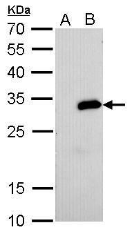 Strep epitope Tag antibody [GT517] detects strep protein by western blot analysis.