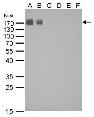 EasyBlot anti-Sheep IgG (HRP) detects native sheep IgG protein by Western blot analysis.