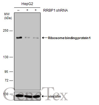 Non-transfected (–) and transfected (+) HepG2 whole cell extracts (30 μg) were separated by 5% SDS-PAGE, and the membrane was blotted with Ribosome binding protein 1 antibody [GT1611] (GTX628997) diluted at 1:500.