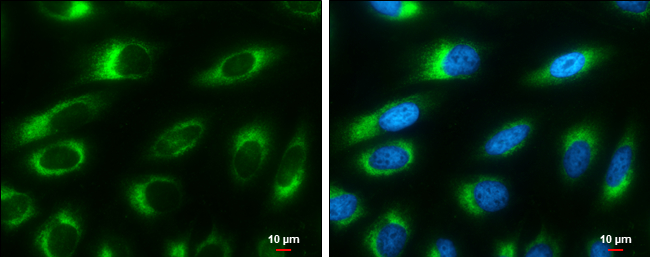 Ribosome binding protein 1 antibody [GT1611] detects Ribosome binding protein 1 protein at endoplasmic reticulum by immunofluorescent analysis. Sample: HeLa cells were fixed in 4% paraformaldehyde at RT for 15 min. Green: Ribosome binding protein 1 stained by Ribosome binding protein 1 antibody [GT1611] (GTX628997) diluted at 1:500. Blue: Hoechst 33342 staining. Scale bar= 10μm.