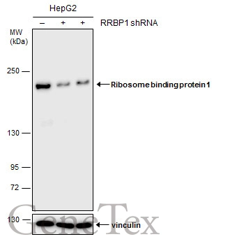 Ribosome binding protein 1 antibody [GT5610] detects Ribosome binding protein 1 protein at endoplasmic reticulum by immunofluorescent analysis.