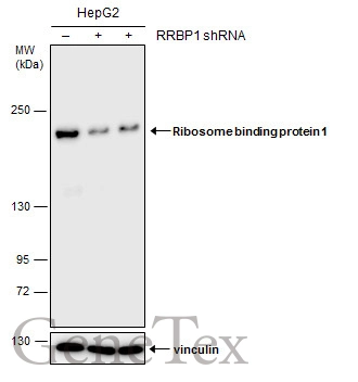 Non-transfected (–) and transfected (+) HepG2 whole cell extracts (30 μg) were separated by 5% SDS-PAGE, and the membrane was blotted with Ribosome binding protein 1 antibody [GT5610] (GTX628998) diluted at 1:500.