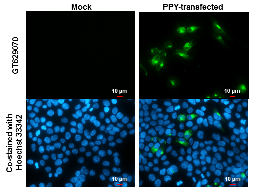 Pancreatic Polypeptide antibody [GT327] detects Pancreatic Polypeptide protein at cytoplasm by immunofluorescent analysis. Sample: Mock and transfected 293T cells were fixed in 4% paraformaldehyde at RT for 15 min. Green: Pancreatic Polypeptide stained by Pancreatic Polypeptide antibody [GT327] (GTX629070) diluted at 1:2000. Blue: Hoechst 33342 staining. Scale bar= 10μm.