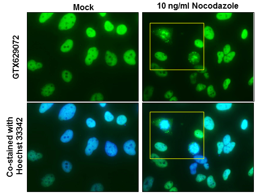 NuMA antibody [GT1510]