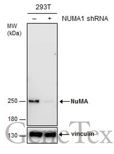 NuMA antibody [GT1510]