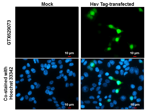 HSV tag antibody [GT223]