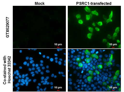 PSRC1 antibody [GT982] detects PSRC1 protein at cytoplasm by immunofluorescent analysis. Sample: Mock and transfected 293T cells were fixed in 4% paraformaldehyde at RT for 15 min. Green: PSRC1 stained by PSRC1 antibody [GT982] (GTX629077) diluted at 1:2000. Blue: Hoechst 33342 staining. Scale bar= 10 μm.