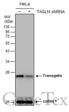 Non-transfected (–) and transfected (+) HeLa whole cell extracts (15 μg) were separated by 12% SDS-PAGE, and the membrane was blotted with Transgelin antibody [GT4511] (GTX629078) diluted at 1:1000.