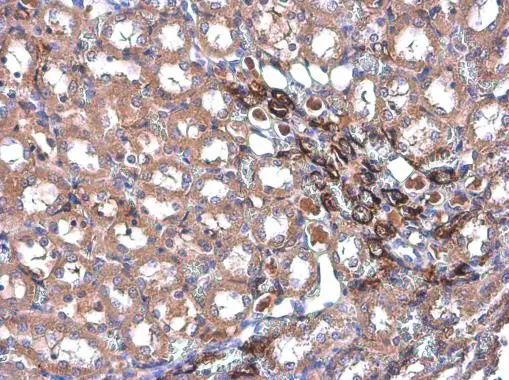 Transgelin antibody [GT4511] detects Transgelin protein at cytoplasm by immunohistochemical analysis. Sample: Paraffin-embedded rat kidney. Transgelin stained by Transgelin antibody [GT4511] (GTX629078) diluted at 1:500.
 Antigen Retrieval: Citrate buffer, pH 6.0, 15 min