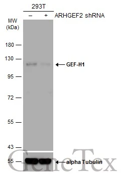 Non-transfected (–) and transfected (+) 293T whole cell extracts (30 μg) were separated by 7.5% SDS-PAGE, and the membrane was blotted with GEF-H1 antibody [GT336] (GTX629398) diluted at 1:500. The HRP-conjugated anti-mouset IgG antibody (GTX213111-01) was used to detect the primary antibody.