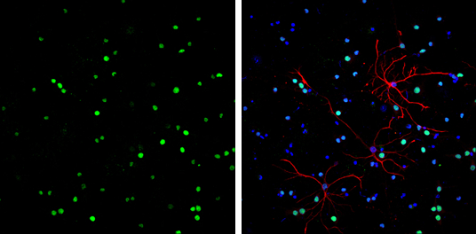 HMGB1 antibody [GT412] detects HMGB1 protein at nucleus by immunofluorescent analysis. Sample: DIV9 rat E18 primary cortical neurons were fixed in 4% paraformaldehyde at RT for 15 min. Green: HMGB1 protein stained by HMGB1 antibody [GT412] (GTX629400) diluted at 1:500. Red: GFAP, a glia cell marker, stained by GFAP antibody (GTX27260) diluted at 1:1000. Blue: Fluoroshield with DAPI (GTX30920).