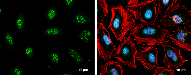 cIAP1 antibody [GT422] detects cIAP1 protein at nucleus by immunofluorescent analysis. Sample: HeLa cells were fixed in 4% paraformaldehyde at RT for 15 min. Green: cIAP1 stained by cIAP1 antibody [GT422] (GTX629402) diluted at 1:500. Red: phalloidin, a cytoskeleton marker, diluted at 1:100. Blue: Hoechst 33342 staining. Scale bar= 10μm.
