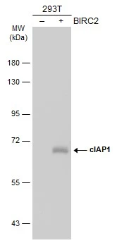 Non-transfected (–) and transfected (+) 293T whole cell extracts (30 μg) were separated by 7.5% SDS-PAGE, and the membrane was blotted with cIAP1 antibody [GT422] (GTX629402) diluted at 1:1000. The HRP-conjugated anti-mouse IgG antibody (GTX213111-01) was used to detect the primary antibody.