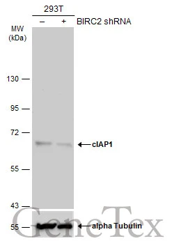 Non-transfected (–) and transfected (+) 293T whole cell extracts (50 μg) were separated by 7.5% SDS-PAGE, and the membrane was blotted with cIAP1 antibody [GT422] (GTX629402) diluted at 1:500. The HRP-conjugated anti-mouse IgG antibody (GTX213111-01) was used to detect the primary antibody, and the signal was developed with Trident ECL plus-Enhanced.