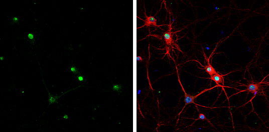 HMGB1 antibody [GT349] detects HMGB1 protein at nucleus by immunofluorescent analysis. Sample: DIV9 rat E18 primary cortical neurons were fixed in 4% paraformaldehyde at RT for 15 min. Green: HMGB1 protein stained by HMGB1 antibody [GT349] (GTX629403) diluted at 1:200. Red: MAP2, stained by MAP2 antibody (GTX133109) diluted at 1:500. Blue: Fluoroshield with DAPI (GTX30920).