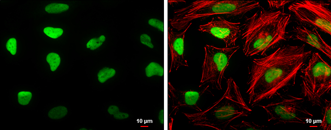 HMGB1 antibody [GT427] detects HMGB1 protein at nucleus by immunofluorescent analysis.