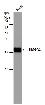 Whole cell extract (30 μg) was separated by 15% SDS-PAGE, and the membrane was blotted with HMGA2 antibody [GT763] (GTX629478) diluted at 1:1000. The HRP-conjugated anti-mouse IgG antibody (GTX213111-01) was used to detect the primary antibody.