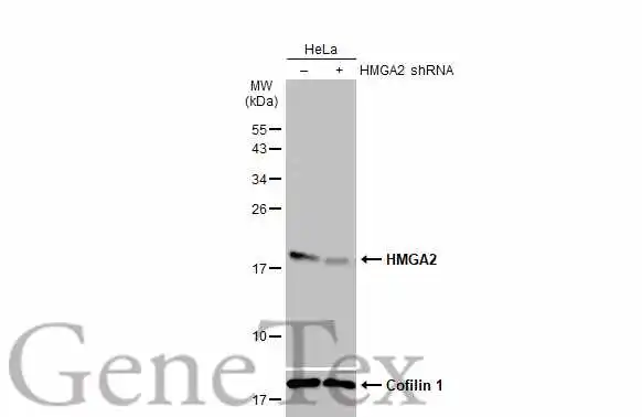 Non-transfected (–) and transfected (+) HeLa whole cell extracts (30 μg) were separated by 15% SDS-PAGE, and the membrane was blotted with HMGA2 antibody [GT763] (GTX629478) diluted at 1:500. The HRP-conjugated anti-mouse IgG antibody (GTX213111-01) was used to detect the primary antibody.