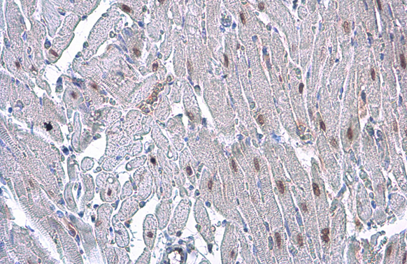 HMGA2 antibody [GT763] detects HMGA2 protein at nucleus by immunohistochemical analysis. Sample: Paraffin-embedded rat heart. HMGA2 stained by HMGA2 antibody [GT763] (GTX629478) diluted at 1:200. Antigen Retrieval: Citrate buffer, pH 6.0, 15 min