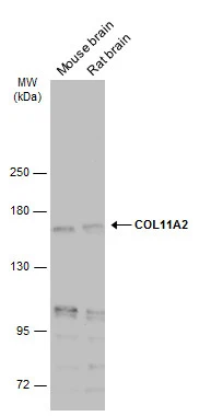 Various tissue extracts (50 μg) were separated by 5% SDS-PAGE, and the membrane was blotted with COL11A2 antibody [GT212] (GTX629481) diluted at 1:500. The HRP-conjugated anti-mouse IgG antibody (GTX213111-01) was used to detect the primary antibody.