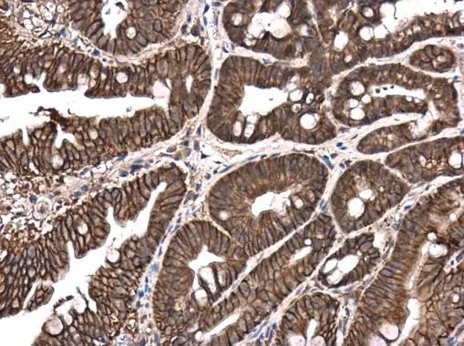 E-Cadherin antibody [GT477] detects E-Cadherin protein at cell membrane and cytoplasm in mouse intestine by immunohistochemical analysis. Sample: Paraffin-embedded mouse intestine. E-Cadherin antibody [GT477] (GTX629691) diluted at 1:250. 
 Antigen Retrieval: Citrate buffer, pH 6.0, 15 min