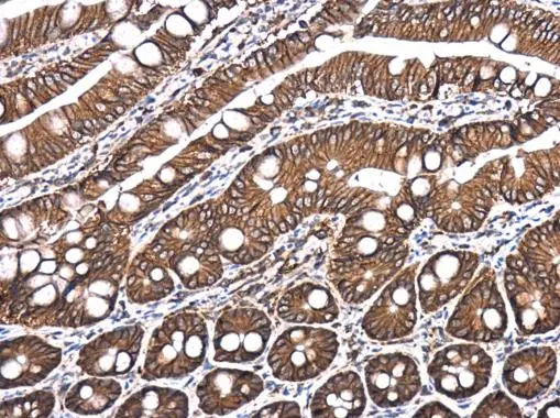 E-Cadherin antibody [GT477] detects E-Cadherin protein at cell membrane and cytoplasm in rat intestine by immunohistochemical analysis. Sample: Paraffin-embedded rat intestine. E-Cadherin antibody [GT477] (GTX629691) diluted at 1:250. 
 Antigen Retrieval: Citrate buffer, pH 6.0, 15 min
