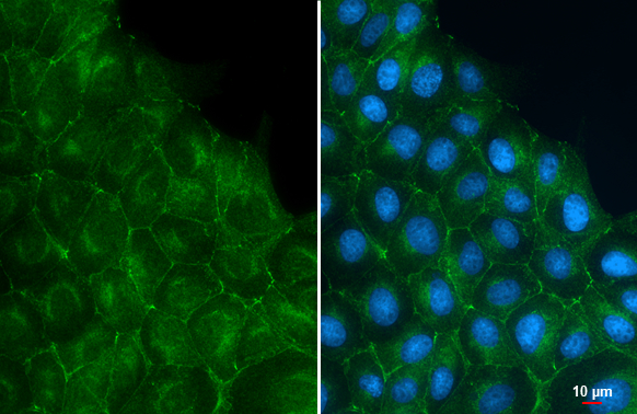 E-Cadherin antibody [GT477] detects E-Cadherin protein at cell membrane by immunofluorescent analysis. Sample: MDCK cells were fixed in 4% paraformaldehyde at RT for 15 min. Green: E-Cadherin stained by E-Cadherin antibody [GT477] (GTX629691) diluted at 1:2000.