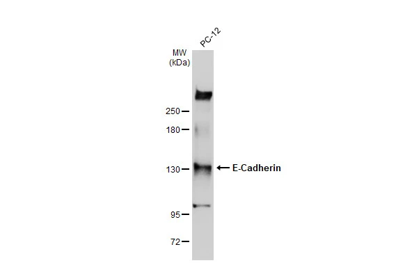 Whole cell extract (30 μg) was separated by 5% SDS-PAGE, and the membrane was blotted with E-Cadherin antibody [GT477] (GTX629691) diluted at 1:500. The HRP-conjugated anti-mouse IgG antibody (GTX213111-01) was used to detect the primary antibody.