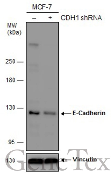 Non-transfected (–) and transfected (+) MCF-7 whole cell extracts (30 μg) were separated by 5% SDS-PAGE, and the membrane was blotted with E-Cadherin antibody [GT311] (GTX629692) diluted at 1:2000. The HRP-conjugated anti-mouset IgG antibody (GTX213111-01) was used to detect the primary antibody.