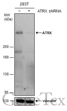 Non-transfected (–) and transfected (+) 293T whole cell extracts (30 μg) were separated by 5% SDS-PAGE, and the membrane was blotted with ATRX antibody [GT4212] (GTX629703) diluted at 1:500.