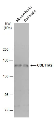 Various tissue extracts (50 μg) were separated by 5% SDS-PAGE, and the membrane was blotted with COL11A2 antibody [GT6410] (GTX629739) diluted at 1:500. The HRP-conjugated anti-mouse IgG antibody (GTX213111-01) was used to detect the primary antibody.