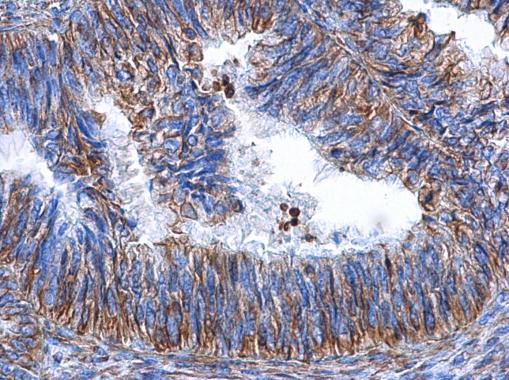 Whole cell extract (30 ug) was separated by 10% SDS-PAGE,and the membrane was blotted with Vimentin antibody [GT7812] (GTX629743) diluted at 1:1000. The HRP-conjugated anti-mouse IgG antibody (GTX213111-01) was used to detect the primary antibody.